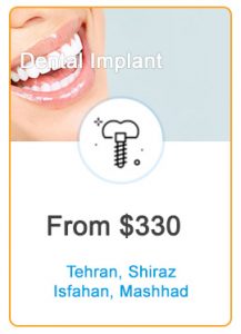 Dental Implant Package in Iran